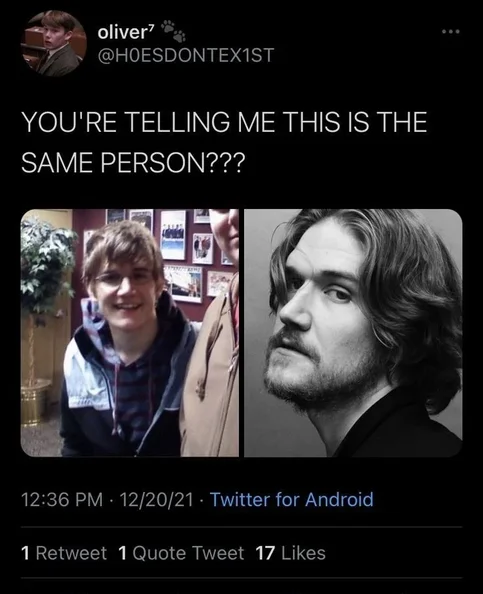 Bo Burnham - Biography, Age, Net Worth, Career & Family Cost of Becoming