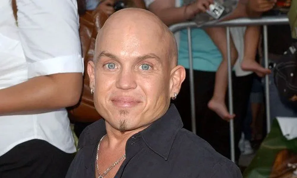 Martin Klebba - Image 1