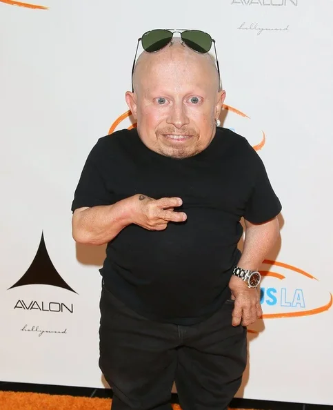 Verne Troyer - Biography, Age, Net Worth, Career & Family Cost of Becoming